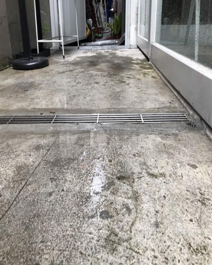特殊：水溝切除完成